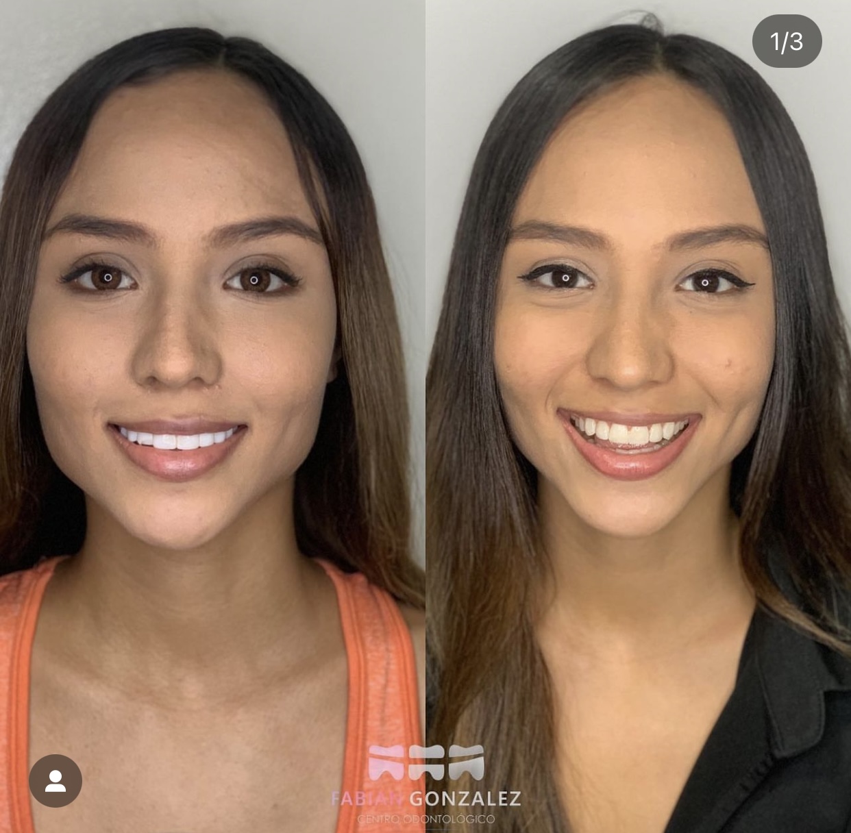 Ortodoncista en Cúcuta