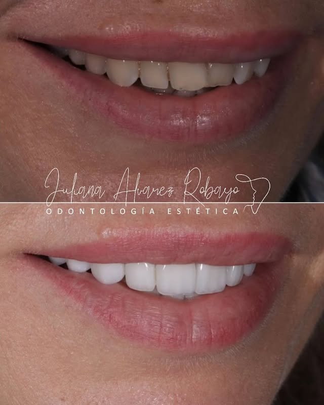 Periodoncista en Cúcuta