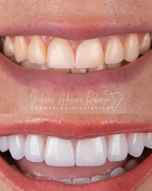 Prostodoncista en Cúcuta